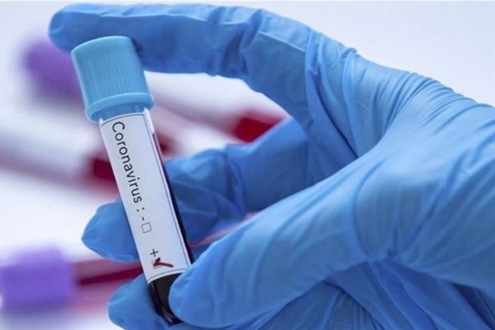 پیشبینی افزایش موارد مثبت کرونا در استان طی هفتهجاری