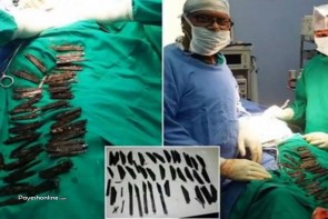 مردی که در چند ماه ۴۰ چاقو را قورت داده است مردی که در چند ماه ۴۰ چاقو را قورت داده است
